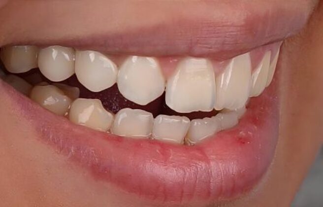 After After - Quality Dental