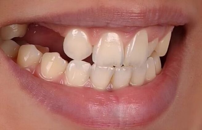 Before  Before - Quality Dental