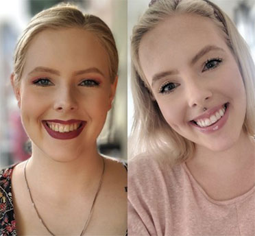 Images by Invisalign®
