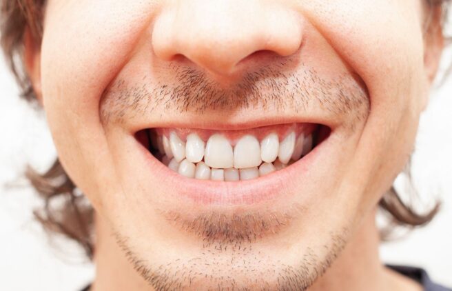 After After - Quality Dental