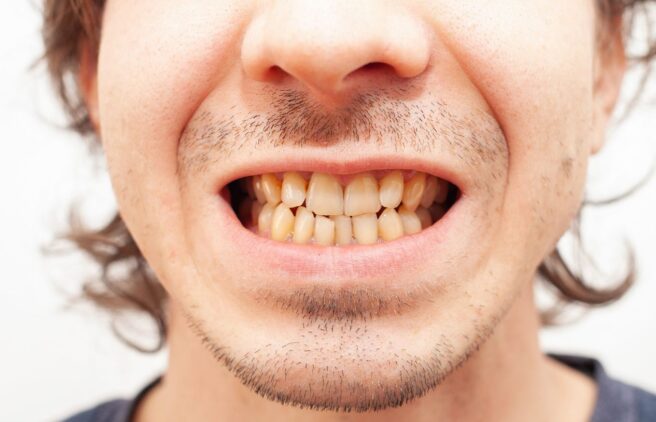 Before  Before - Quality Dental