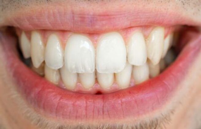 After - Quality Dental