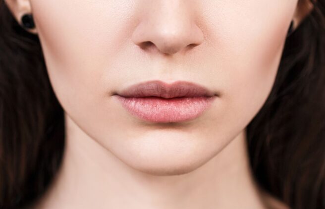 After After - Quality Dental