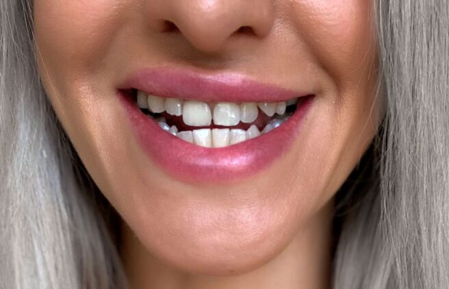 After - Quality Dental