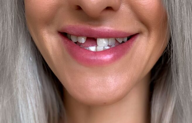 Before - Quality Dental